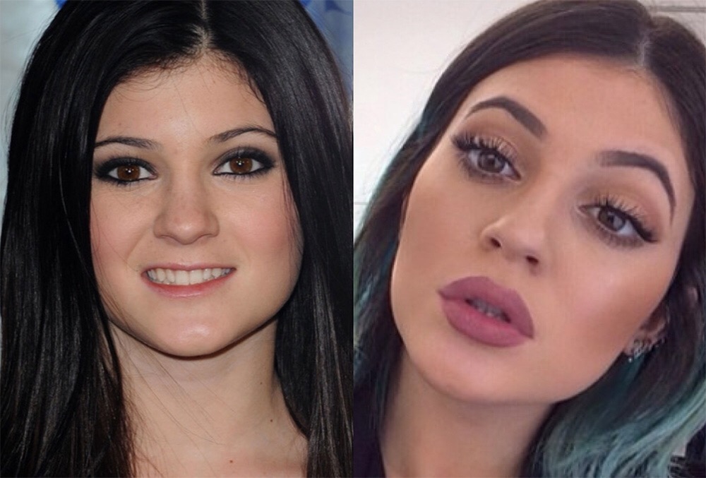 12-celebrity-transformations-that-have-baffled-millions-of-fans4