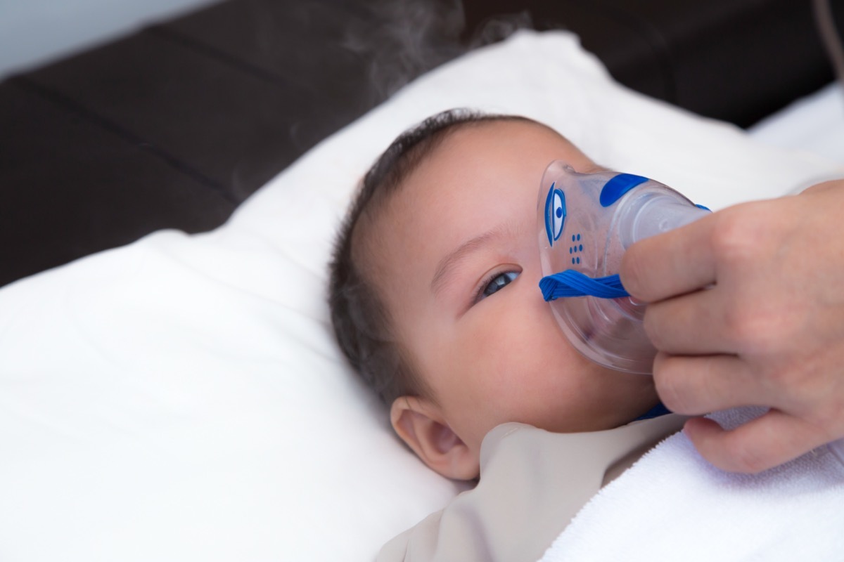 5 months old baby with respiratory syncytial virus, inhaling medication through inhalation mask while looking at with his tired eyes