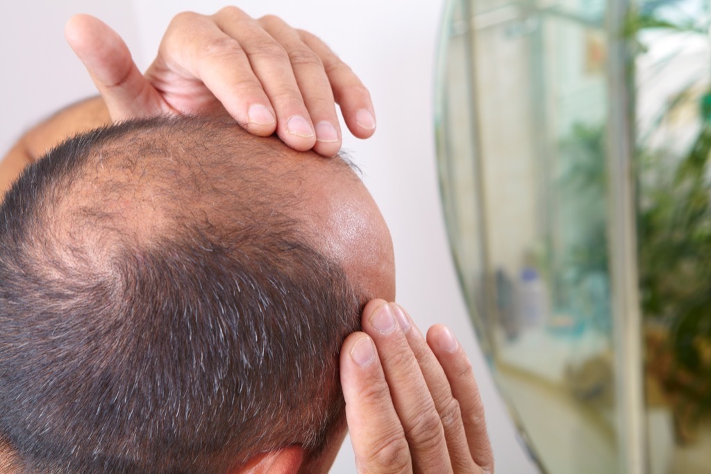 balding man checking his hair