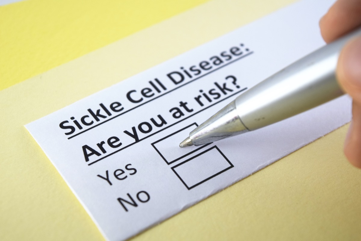 sickle cell disease