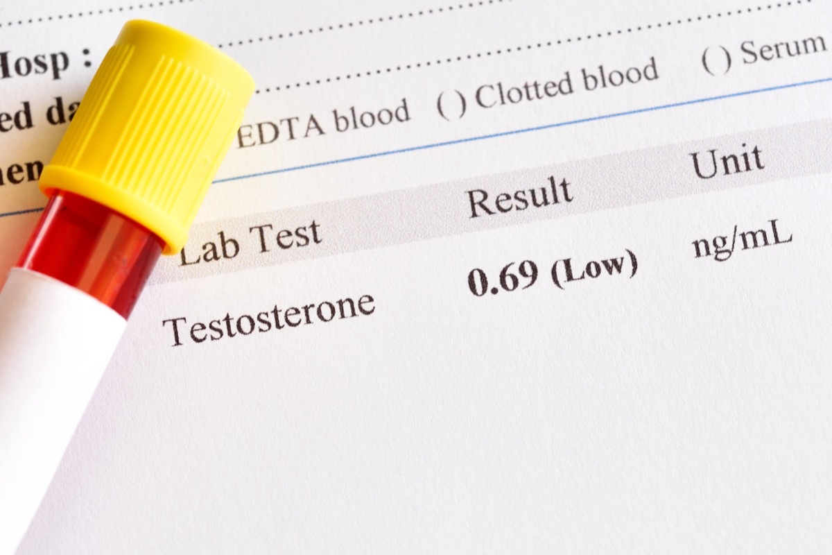 testosterone lab results test